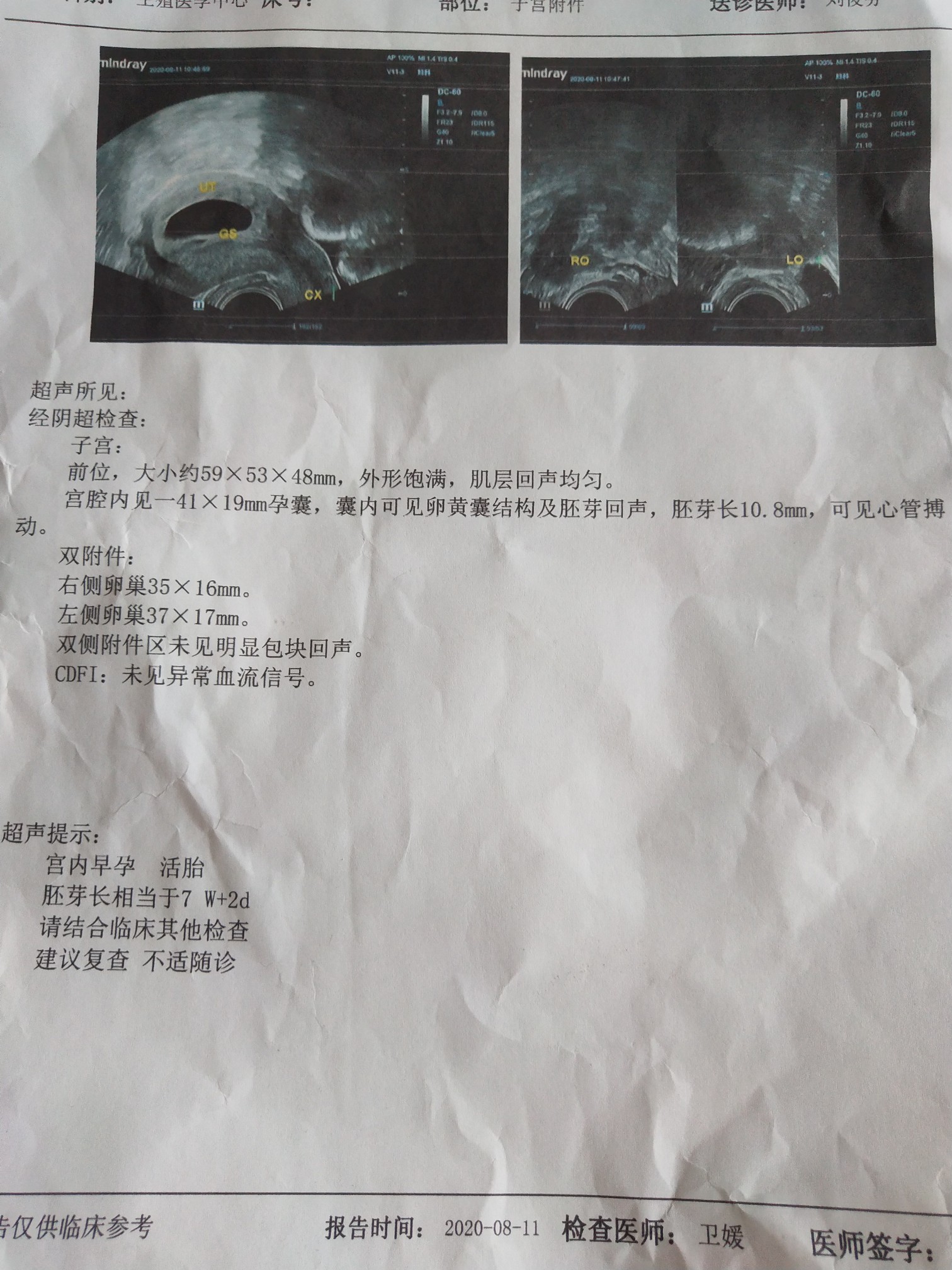 南京私立供卵中心-武汉私立供卵试管婴儿代怀生子医院排名附试管助孕机构名单