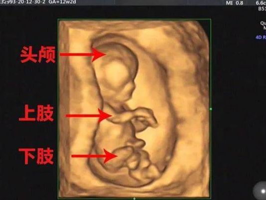 四维有这个一般是女孩?2025年超声新规下别再拿排畸当开奖