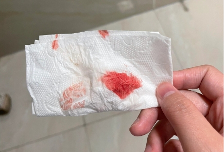 受精卵着床时会出血