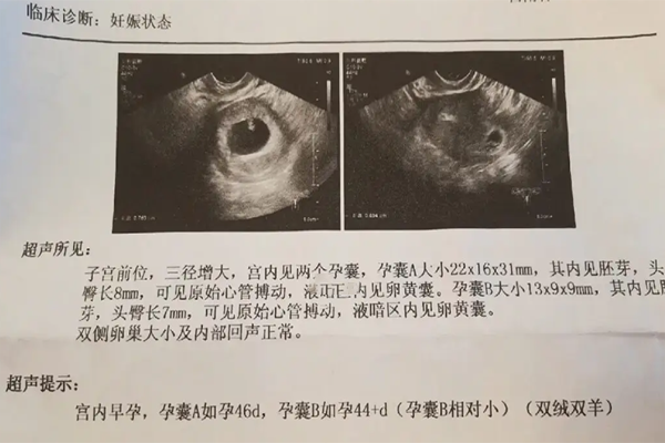 第三代试管孕囊偏小6天该怎么办呢?
