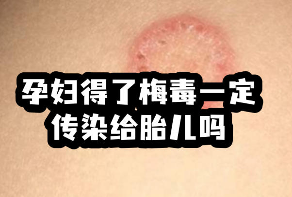梅毒有可能会传染给宝宝