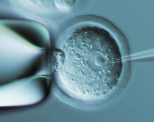 胚胎质量影响成功率