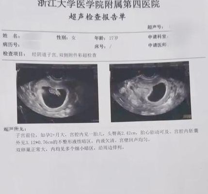 孕妇梦见胎儿性别准吗？试管三年，胎梦这事我真信了