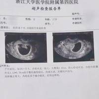 孕妇梦见胎儿性别准吗？试管三年，胎梦这事我真信了
