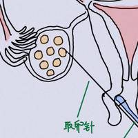 试管取卵9个7个异常胚胎?先别崩溃这个数字没那么可怕