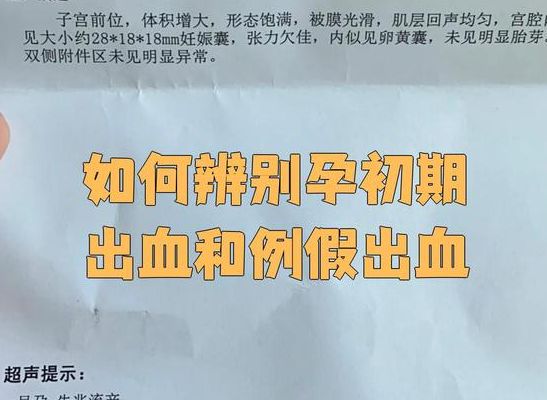 怎么分清姨妈血和早孕血?看时间颜色和量,先别慌