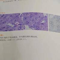 试管三代基本不会胎停吗？PK 一二代试管：染色体筛查挡不住所有胎停