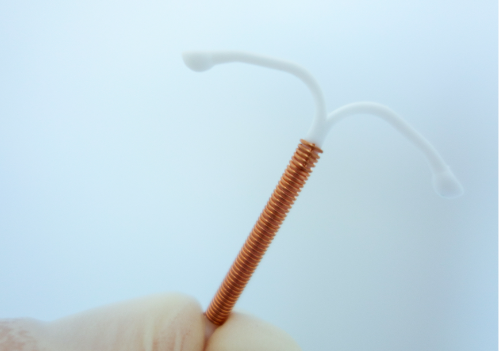 取环可以选择无痛的