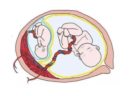高龄试管放2个胚胎的成活率有多少?