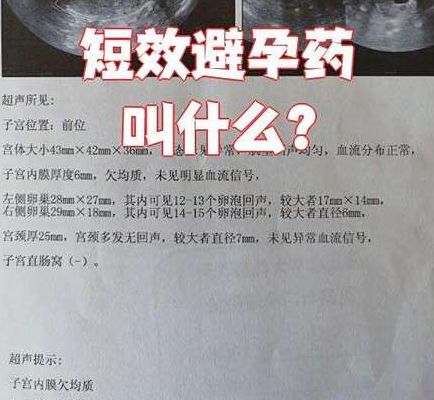 短效避孕药的危害和副作用PK：复方与单孕激素谁更轻？