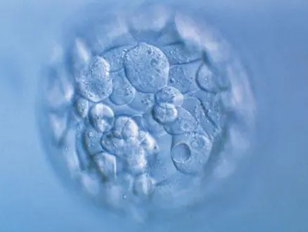 三代试管婴儿是移植鲜胚好还是囊胚好？筛查后只能移植囊胚吗?