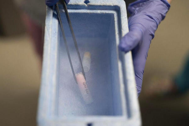 冷冻精子费用受储藏年限影响