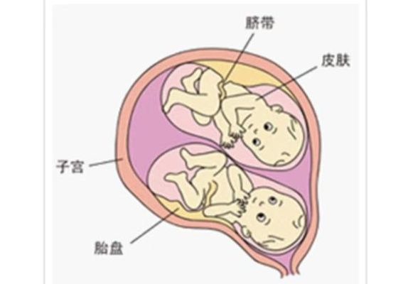 同卵双胞胎dna完全一样吗?一个生殖中心咨询师的实话