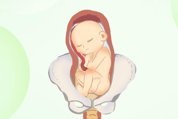 胎位不正会影响顺产