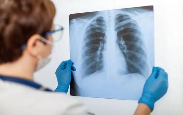 肺部nt检查会让孩子会暴露于辐射