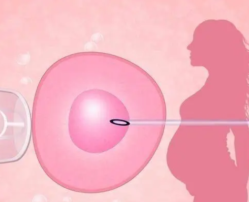 宫外孕女性能移植双胎