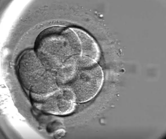 移植胚胎级别不决定智商