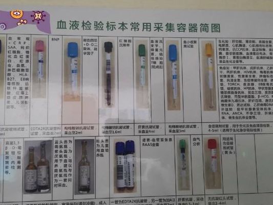 抽血化验的试管颜色我全认得了，讲讲我的试管路