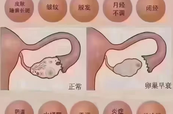 卵巢早衰可以通过中药进行调理