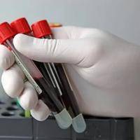 去香港验血的中介靠谱吗？专家解析避坑指南