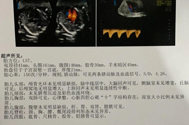 二维大排畸检查是全面的