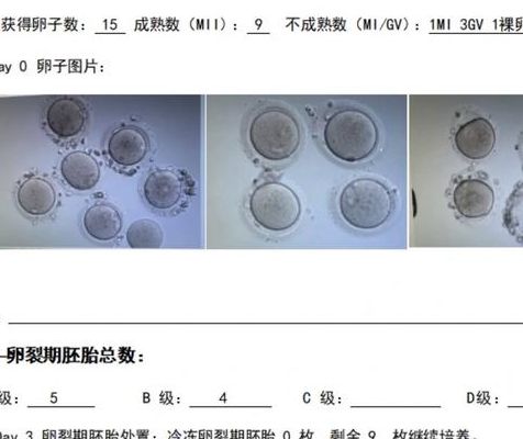 45岁试管一次成功率：自卵5% PK 供卵50%，差的不是运气是选择