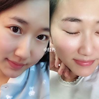试管婴儿能活多久,哪些不一样？关键看这三点而非受孕方式