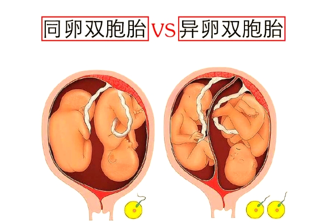 同卵双胞胎和异卵双胞胎