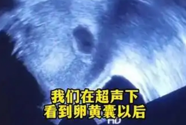 孕周计算不准确暂时看不到卵黄囊