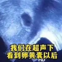 没有卵黄囊是不是就没有希望了?胚胎发育时间因人而异