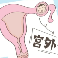 供卵代怀孩子哪里找,哪里找供卵者月经不调备孕五个月终于好孕了上