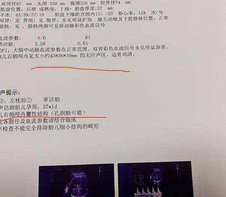 cd38阳性有怀孕的吗 我折腾两年终于怀上了