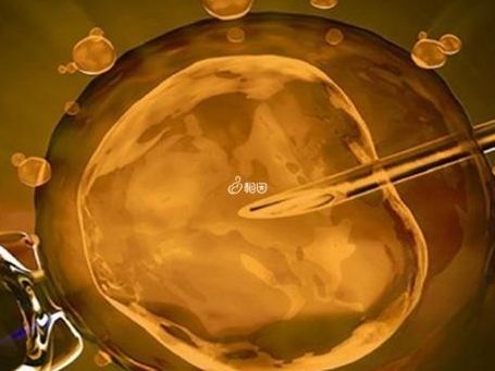 2026去格鲁吉亚做试管条件：新法生效，三类人需先掂量