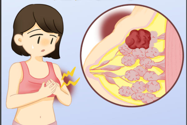 良性乳腺结节一般不用做手术