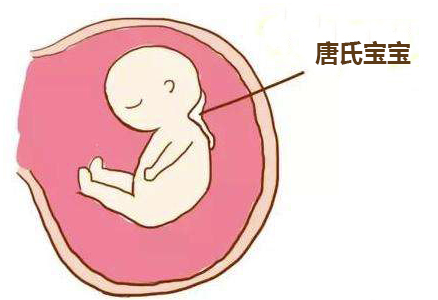 唐宝宝在孕期的症状.png