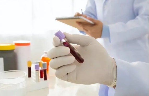 千万不要用血做基因检测