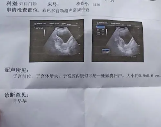 北京代生孩子哪里有北京去哪里做试管婴儿好