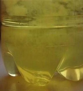 尿液酸碱度不能预测胎儿性别