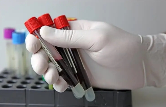 三分钟看懂甲功五项化验单