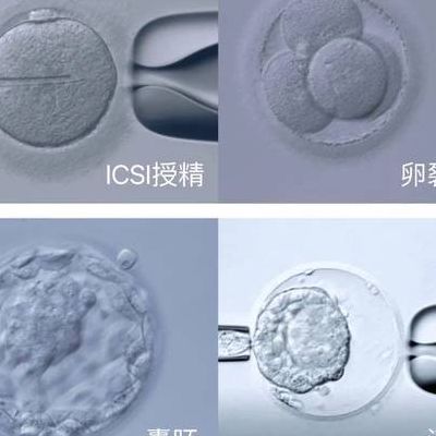 一代二代三代试管婴儿区别在哪？拼缘分、拼技术、拼筛选，别盲目追高