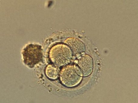 受精卵5天可以培养成囊胚