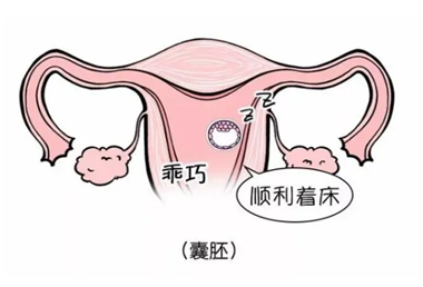 囊胚移植不着床的征兆有哪些