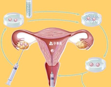 试管婴儿打亮丙瑞林多久可以卵母细胞采集？关键看降调后这3步