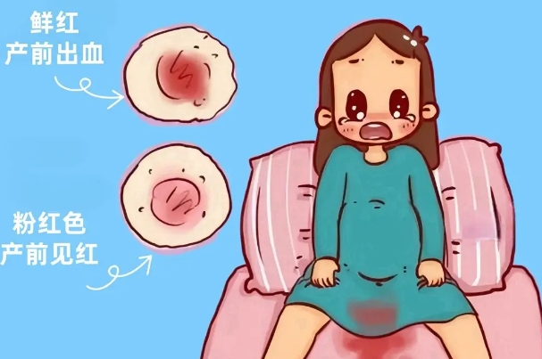 顺产破水比见红更危险