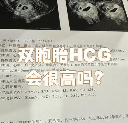 hcg高假怀孕虚惊一场,不是怀孕的几种可能很多人不知道