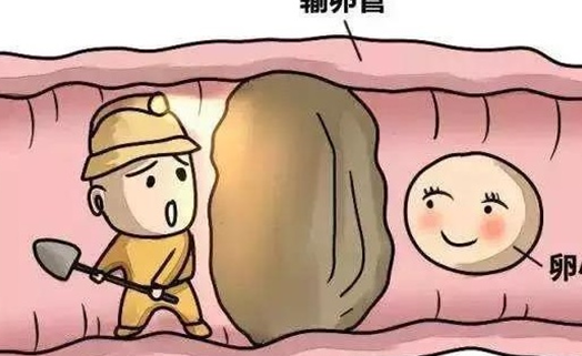 试管婴儿宫外孕怎么治疗优质？先别慌，看这三步处理方案