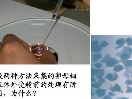 卵母细胞采集19颗却一颗不受精，医生一句话点醒了我