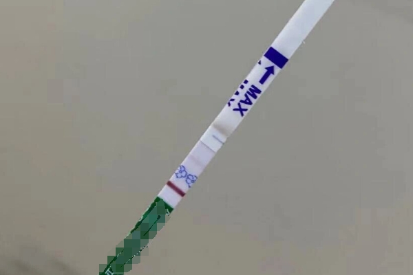 囊胚移植后一般第14天检测