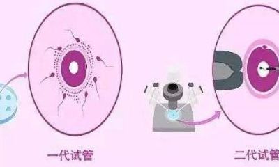 不孕不育大概需要多少钱？试管费用5笔开销明细，过来人帮你梳理