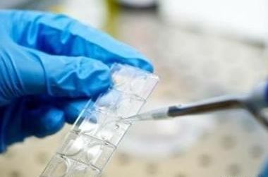 试管婴儿费用多少钱？过来人帮你梳理7笔开销与价格明细